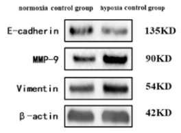 MMP9 Antibody - Figure 7.