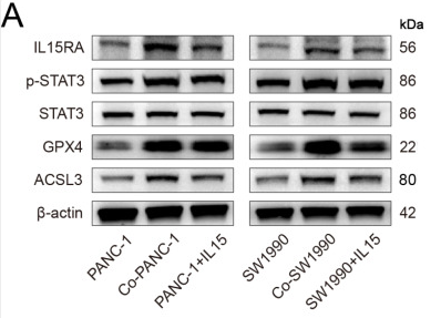 beta Actin Antibody - Figure 4 .