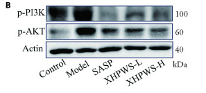 Phospho-PI3K p85 alpha (Tyr607) Antibody - Figure 4.