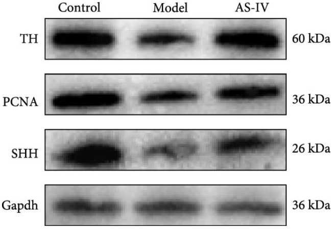 PCNA Antibody - Figure 7 (a) Protein changes in the rat brain were investigated and subjected to statistical analysis.