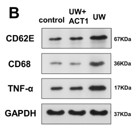 SELE/CD62E Antibody - Fig 3.