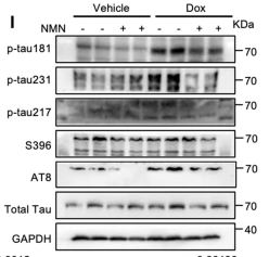 Phospho-Tau (Thr231)[Thr548] Antibody - Fig.