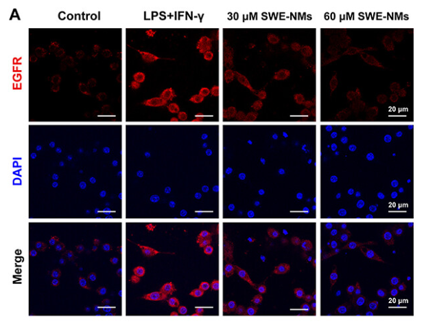 EGFR Antibody - Figure 9 The effects of SWE-NMs on expression of EGFR (A and B), JNK (C and D) and MMP9 (E and F).
