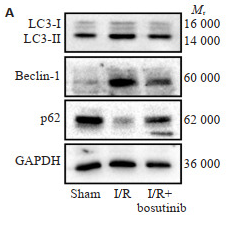 SQSTM1/p62 Antibody - 图 5 各组大鼠心肌组织中LC3、Beclin-1、p62蛋白表达 Expression of LC3, Beclin-1 and p62 proteins in the myocardial tissue in each group.