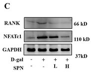 TNR11 Antibody - Figure 3 SPN suppressed bone resorption in D-gal-induced mice.