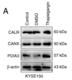 Calnexin Antibody - Figure 4 - CALR regulates IP3R calcium ion release channels and ER stress.