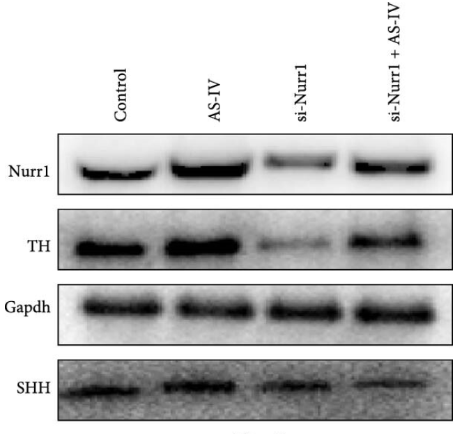 Nurr1/NR4A2 Antibody - Figure 4 (a) siRNA interferes with intracellular protein expression: (a) and (b) western blotting for protein expression of Nurr1, TH, and SHH after transfection of si-Nurr1 and si-SHH; (c) and (d) One-way ANOVA statistics of the data using SPSS; data are expressed as mean ± SEM; n ≥ 3, ( ∗P < 0.