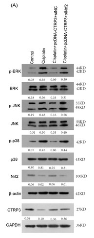 Nrf2 Antibody - Figure 8: Effect of siNrf2 on MAPK signaling pathway.