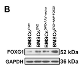 FOXG1 Antibody - Fig.