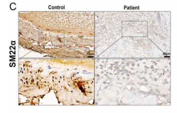 SM22 alpha Antibody - Fig.