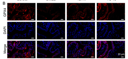 GPX4 Antibody - Figure 4 YS-10 ameliorates DMED by inhibiting ferroptosis.