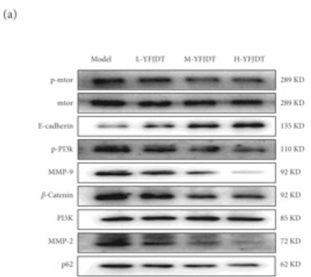 PI3K p85 alpha Antibody - Figures 3.