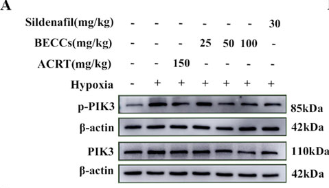 Phospho-PI3K p85 alpha (Tyr607) Antibody - Figure 5.