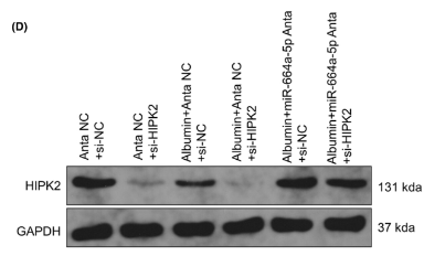 HIPK2 Antibody - FIGURE 2 Binding detection of miR-664a-5p and the 3′UTR of HIPK2 mRNA and effects of HIPK2 knockdown on HIPK2 expression and damage in HK-2 cells treated with miR-664a-5p antagomir and albumin.