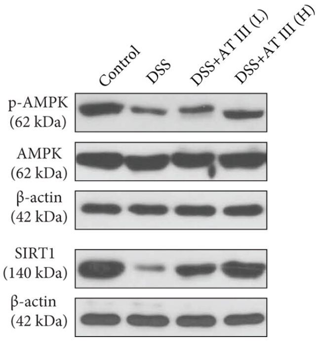 Phospho-AMPK alpha (Thr172) Antibody - Figures 4.