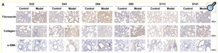 Collagen I Antibody - Figure 4 .