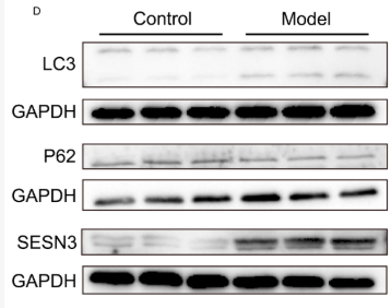 SQSTM1/p62 Antibody - Figure 8.