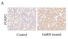 FOXP2 Antibody - Fig.