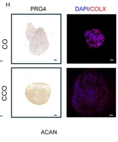 Collagen X Antibody - Fig.