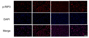 Phospho-RIP3 (Ser232) Antibody - Fig.