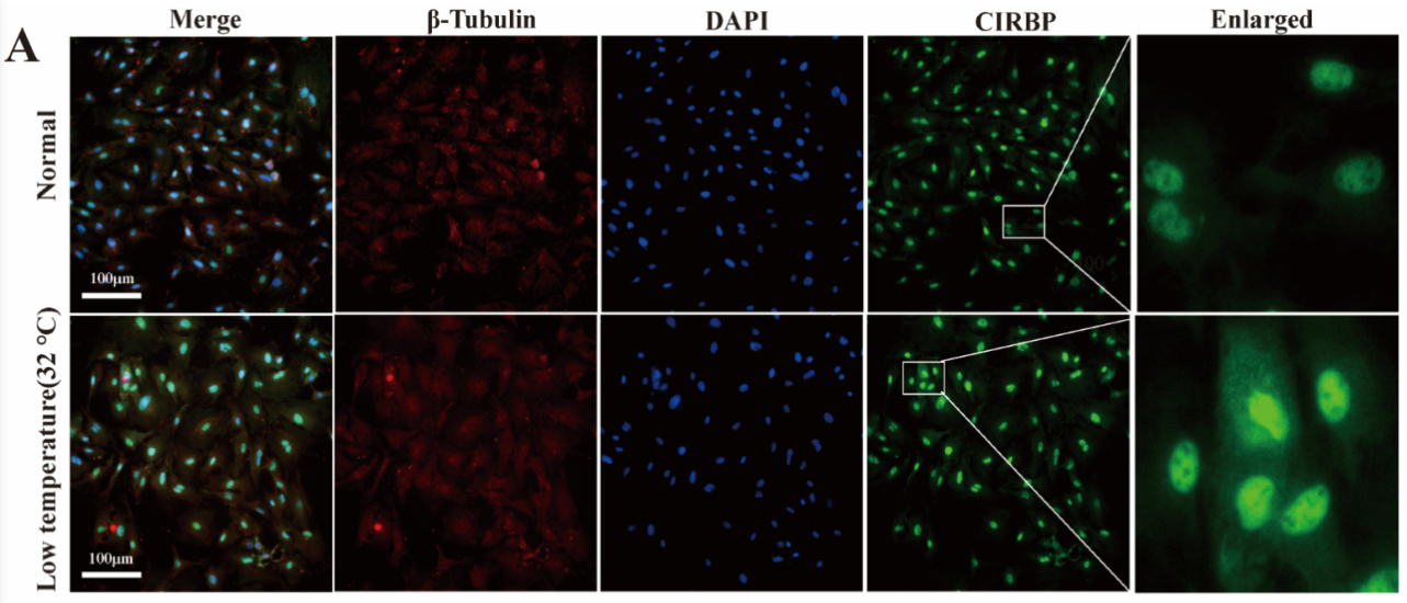 CIRBP Antibody - Figure 1.