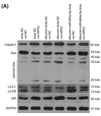 CAPN1 Antibody - FIGURE 3 Effects of miR-664a-5p/HIPK2/Calpain1/GSα signal pathway-mediated autophagy inhibition in HK-2 cells injury caused by albumin.