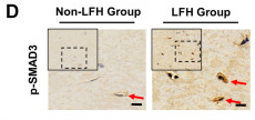 Phospho-Smad3 (Ser425) Antibody - Fig.