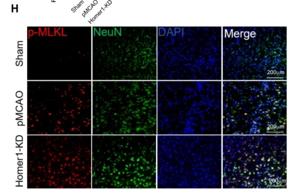 Phospho-MLKL (Thr357) Antibody - Fig.