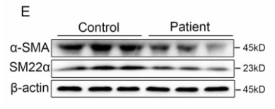 alpha-SMA Antibody - Fig.