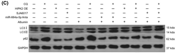 LC3A/B Antibody - FIGURE 3 Effects of miR-664a-5p/HIPK2/Calpain1/GSα signal pathway-mediated autophagy inhibition in HK-2 cells injury caused by albumin.