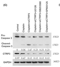 BATF Antibody - Figure 7: Effect of the inhibitors of MAPK pathway on cisplatin-induced inflammation and apoptosis.