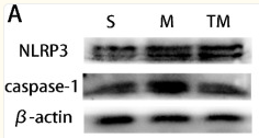 Caspase 1 Antibody - Figure 3.