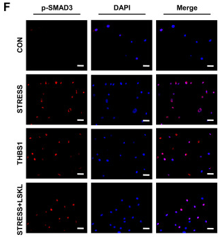 Phospho-Smad3 (Ser425) Antibody - Fig.