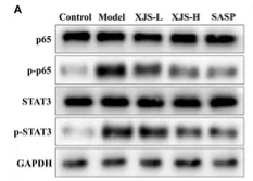 Phospho-STAT3 (Tyr705) Antibody - FIGURE 7.