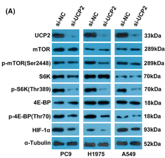 Phospho-p70 S6 Kinase (Thr389/Thr412) Antibody - FIGURE 4 UCP2 promoted NSCLC progression through the mTOR/HIF-1α pathway.