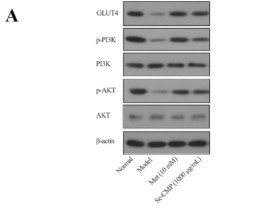 Phospho-PI3K p85 alpha (Tyr607) Antibody - FIGURE 7 The expression variations of GLUT4, p-PI3k/PI3K, p-AKT/AKT in cells were determined by Western blot, with β-actin serving as a loading control (A), and comparison of the levels of the phosphorylated protein relative to their non-phosphorylated counterparts in gray scale (B–D).