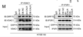 IP3 Receptor Antibody - Figure 4 - CALR regulates IP3R calcium ion release channels and ER stress.