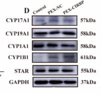 Cytochrome P450 19A1 Antibody - Figure 3.