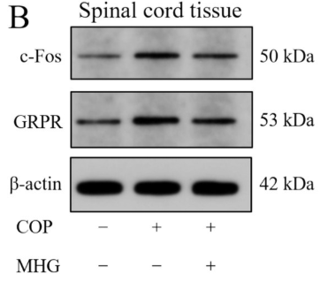 GRPR Antibody - Figure 4.