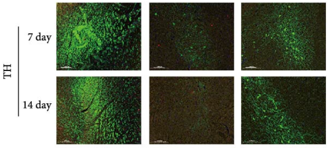 Tyrosine Hydroxylase Antibody - Figure 6 (a) Immunofluorescence was employed to detect protein expression in rat brain tissue, followed by statistical analysis: (a) brain sections treated with DAPI (blue), PCNA (red), TH (green), Tuj-1 (orange), 7 and 14 days after AS-IV intervention, observed under a 10x microscope (scale bar = 100 μm); (b) staining of the brain sections with DAPI (blue), GFAP (green), caspase-3 (red) (scale bar = 100 μm), arrows represent caspase-3 protein fluorescence; (c) statistical comparison of fluorescence intensities of PCNA by the independent samples t test for PCNA; (d) fluorescence intensity of TH by independent samples t test; (e) fluorescence intensity of PCNA by independent samples t test; (f) fluorescence intensity of caspase-3 by independent samples t test; the data are expressed as mean ± SEM; n ≥ 3, ( ∗P < 0.