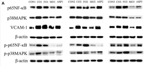 NF-kB p65 Antibody - Figure 6.