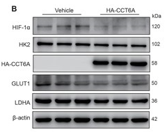 LDHA Antibody - Figure 4CCT6A mediates a reduction in lactate levels by inhibiting HIF-1α-mediated glycolysis.