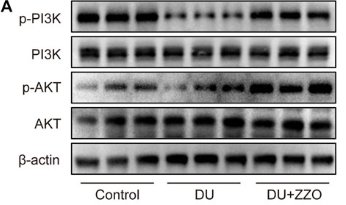 beta Actin Antibody - FIGURE 8.