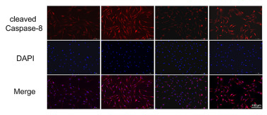 Cleaved-Caspase 8 (Asp384) Antibody - Fig.