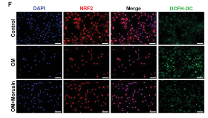 Nrf2 Antibody - Figure 5 Morusin alleviates the senescence of VICs through CCND1/Nrf2 pathway.