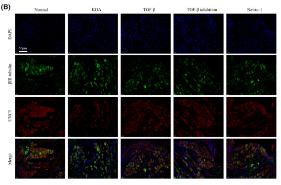 UNC5B Antibody - FIGURE 2 KOA synovial fibrosis initiates Netrin-1 induction of sensory nerve germination.