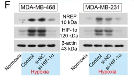 HIF1A Antibody - Fig.