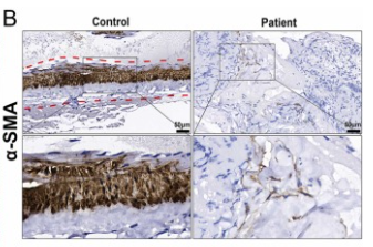 alpha-SMA Antibody - Fig.