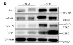 alpha-SMA Antibody - Figure 1 Postn+ cell lineage tracing during lung fibrosis.