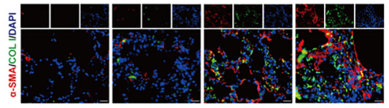 alpha-SMA Antibody - Figure 2 NPNT deficiency exacerbated BLM-induced pulmonary fibrosis and pulmonary dysfunction in mice.